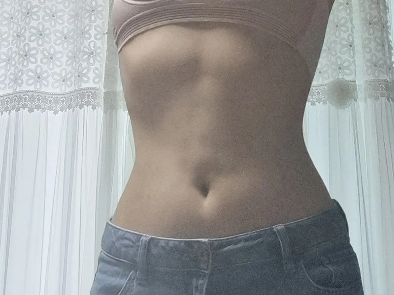 腹部吸脂 术后
