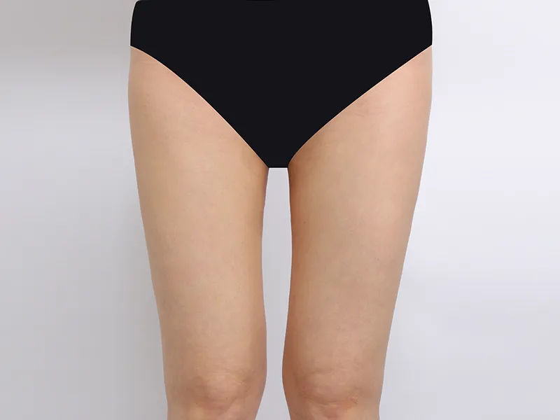 大腿吸脂 术后