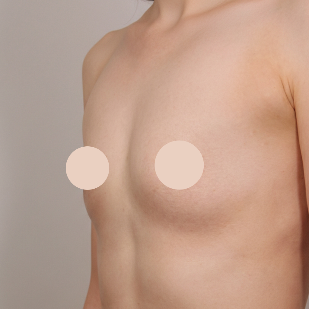 Case 01 수술 전 (참고)