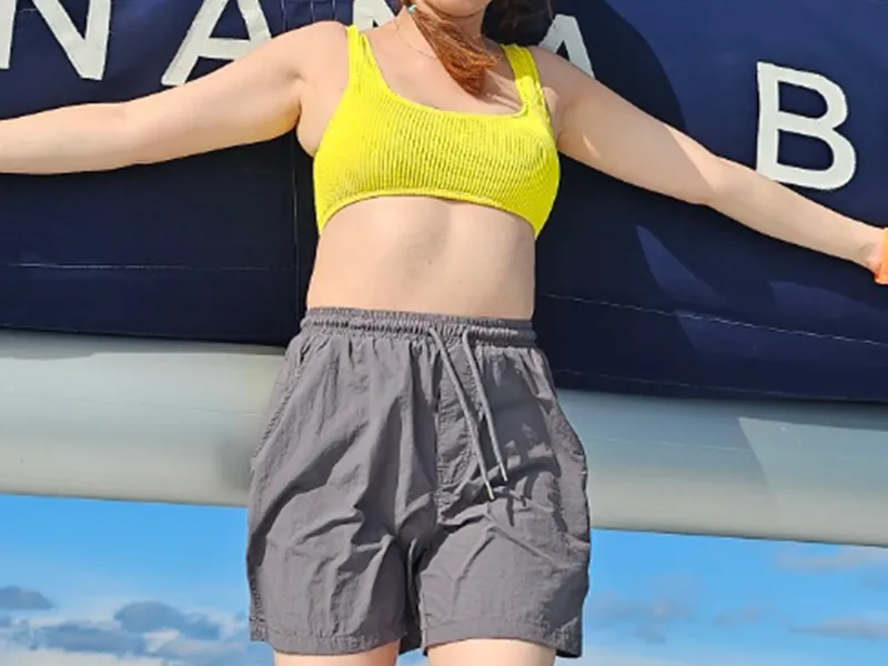 二の腕脂肪吸引 術前