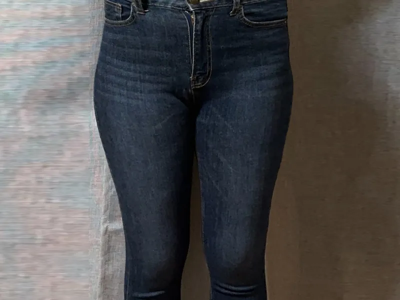 太もも脂肪吸引 術前