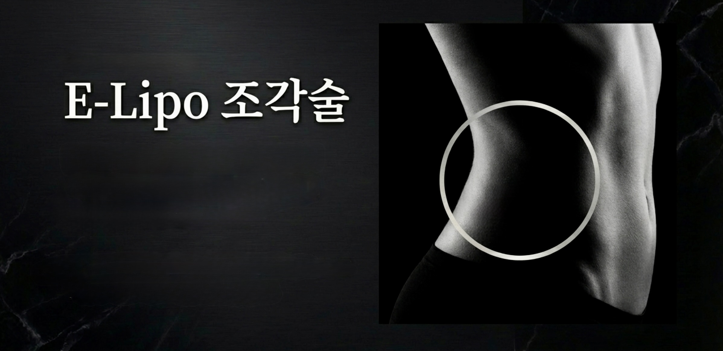 STEP 1 E-Lipo 조각술 뒷구리 옆구리 승마살 지방흡입