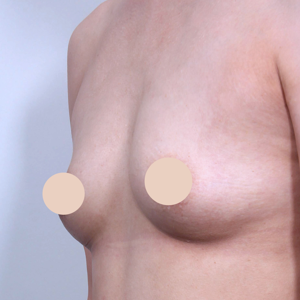 Case 02 before (reference)